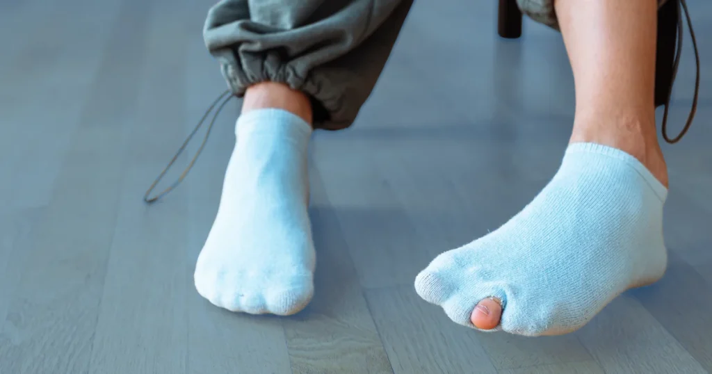 This is why you're getting holes in your socks